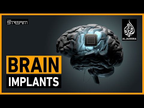 What does the future hold for brain implant technology? | The Stream