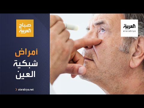 صباح العربية | كيف تتعامل مع أمراض شبكية العين؟