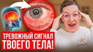 видео: САМАЯ СИЛЬНАЯ БОЛЬ в мире! Как ВЫЖИТЬ при кластерной головной боли? картинка: САМАЯ СИЛЬНАЯ БОЛЬ в мире! Как ВЫЖИТЬ при кластерной головной боли?