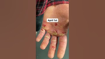 Thumbnail of 4100 pull-ups done in 17 and a half hours. Easy day!