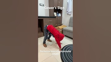 Gower’s Sign: Duchenne muscular dystrophy (DMD) #musculardystrophy #duchennemusculardystrophy