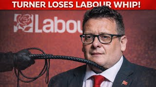 Famous Karl Turner Has Whip Removed! Wealth