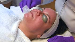 Kansas City Skin & Cancer Center - Dermaplaning Facial