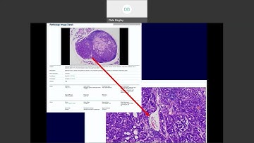 MGI IntroMMHCdb Overview