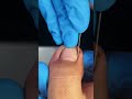 Satisfying nail cleaning process#nailcare #pedicure #satisfying #nailtech #oddlysatisfying #fyp