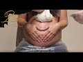 Pregnancy Belly Cast With Hands - Heart Belly Gipsabdruck