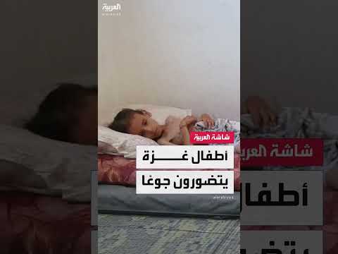هزال أطفال غزة: نقص الغذاء بسبب الحرب