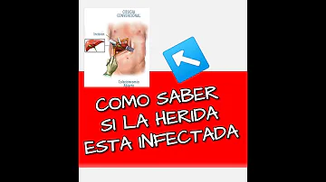 ¿Cómo saber si la incisión de la esterilización está abierta?