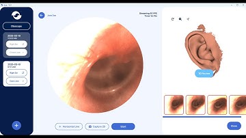 Ear Scan by Empress 3D Ear Scanner - Xavier