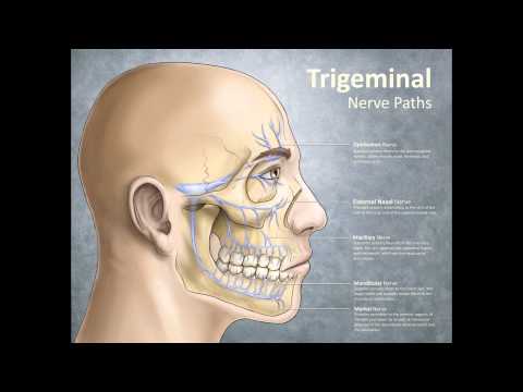 What Treatment Trigeminal Neuralgia Facial Nerve Pain