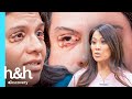 "Que são estes nódulos nas pálpebras?" | Dra. Sandra Lee: A Rainha dos Cravos | Discovery H&H Brasil