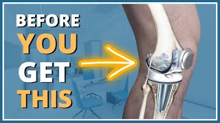 5 things you MUST know before getting a knee replacement