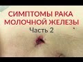 Симптомы рака молочной железы. Часть 2.