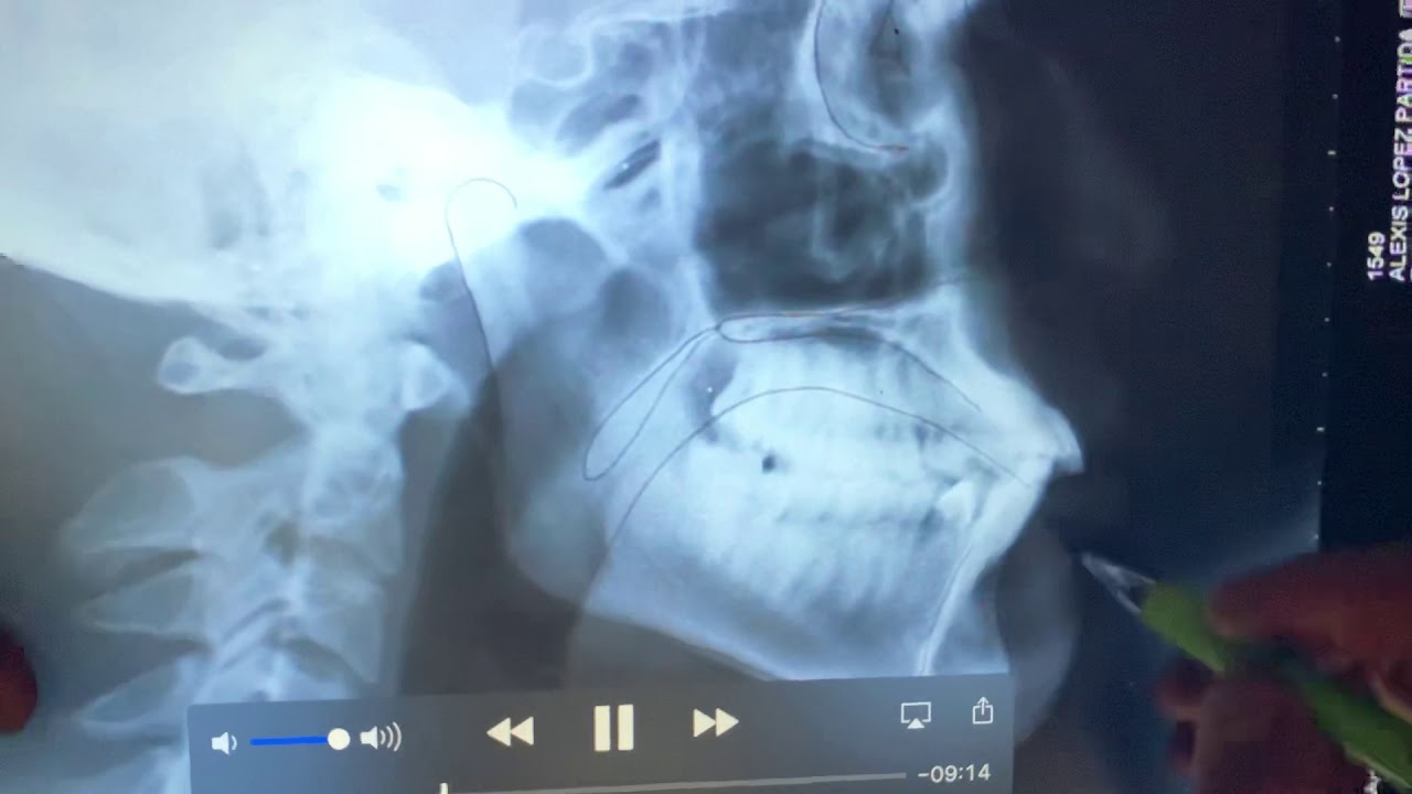 Radiografía Lateral de cráneo DR FEDE