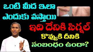 లావున్న వారికీ Stretch Marks రాకుండా చేసే Oil | Argan Oil | Weight Loss |Manthena Satyanarayana Raju