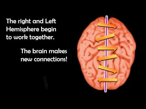 Cross-Lateral Brain Benefits