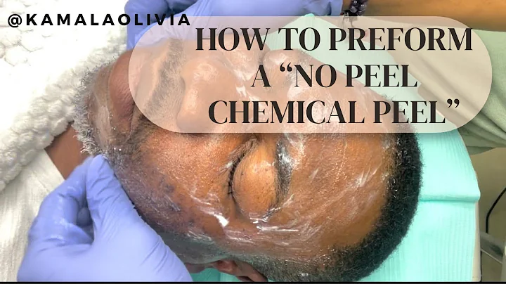 COMPLETE PROCESS CHEMICAL PEEL STEPS