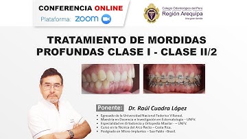 TRATAMIENTO DE MORDIDAS PROFUNDAS CLASE I - CLASE II/2