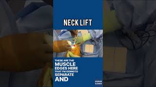*Graphic Content* This is how I perform a Neck lift on my patients and tighten the neck bands 😊