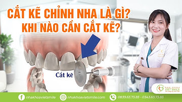 Cắt kẽ răng để niềng gì? Khi nào cắt kẽ răng- Bác sĩ trả lời