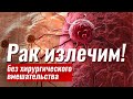 Возможно ли исцеление от рака?