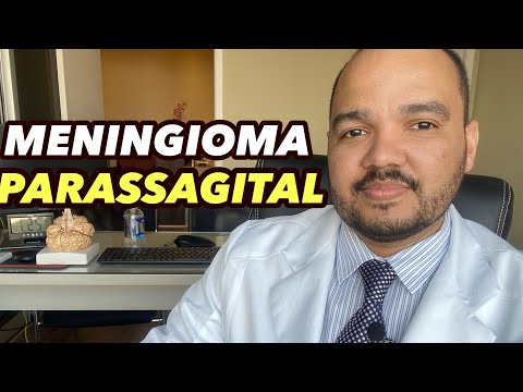 Meningioma Parassagital