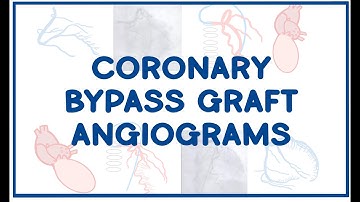 CABG Coronary Artery Bypass Graft ANGIOGRAMS