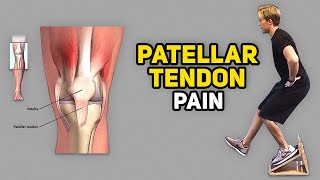 3 Exercises for Jumper’s Knee (Patellar Tendinopathy)