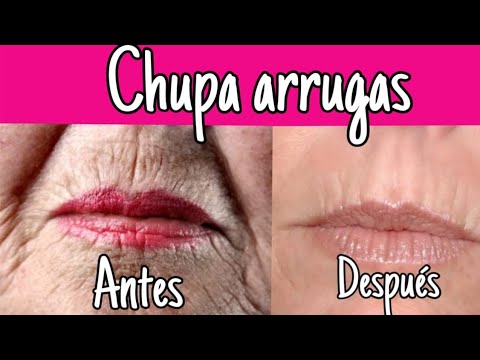 COMO ELIMINAR ARRUGAS ALREDEDOR DE LA BOCA/EL CHUPA ARRUGAS