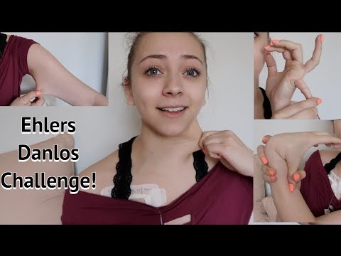 EHLERS DANLOS CHALLENGE *EDS Awareness Month 2018*
