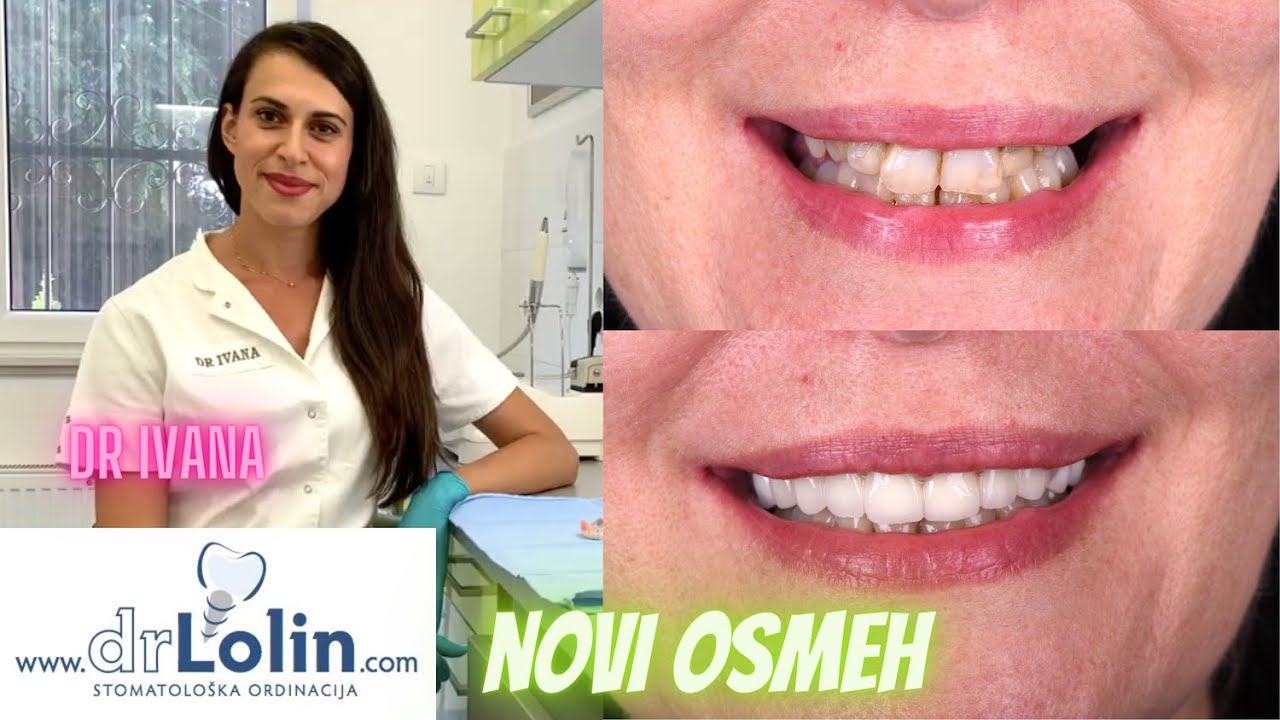 Zubni most i proteza na kopčanje