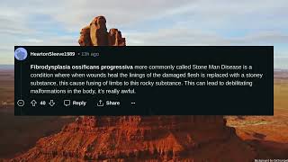 Which Random Fact You Know That Not A Lot Of People Know