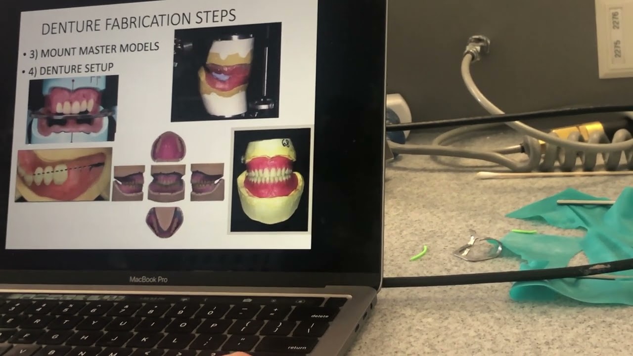 Lab Procedures for Removable Prosthetics - Larry Borgeson ...