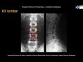 Anatomía Rx Simple Lumbar