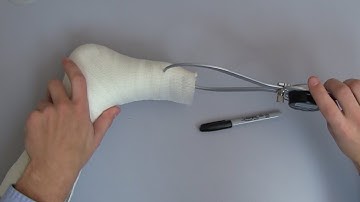 How to | Measure Cast Thickness