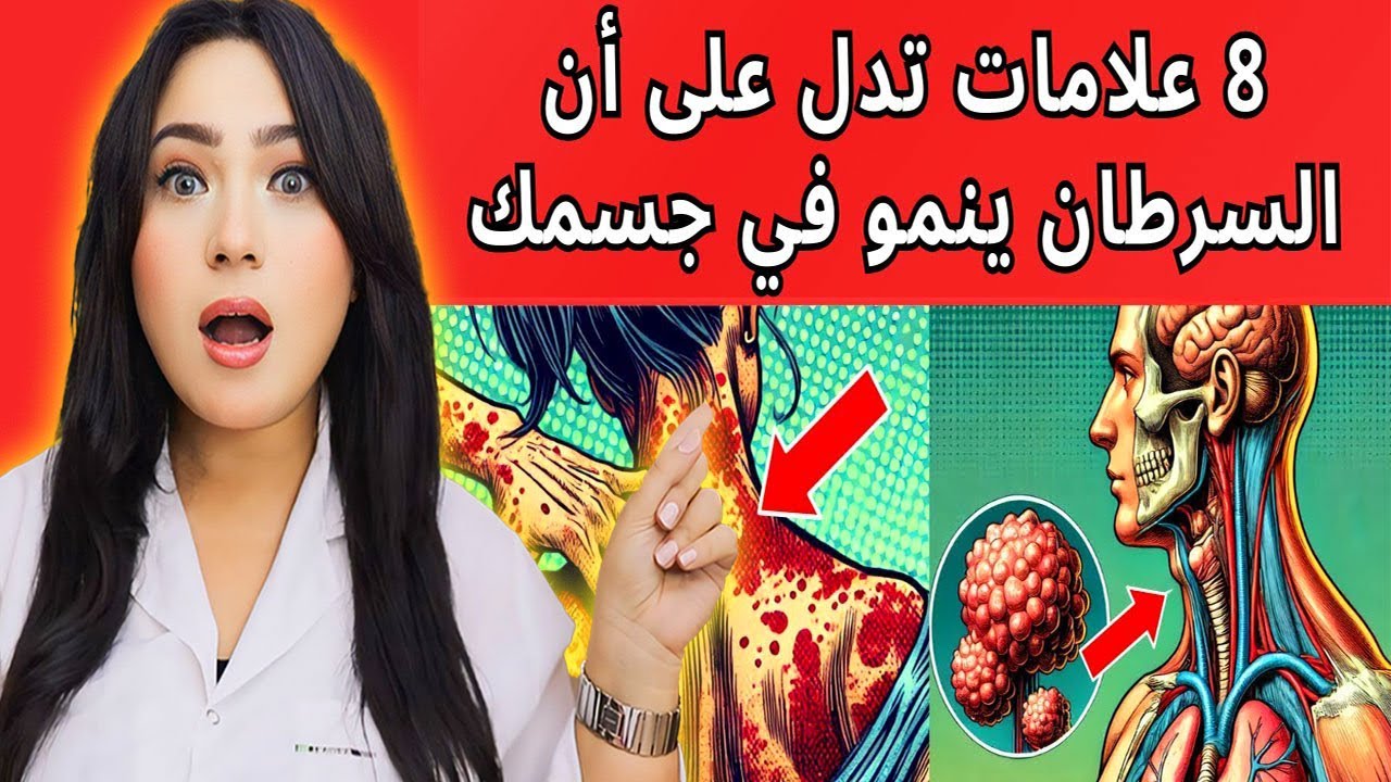 8 علامات مبكرة تدل ان السرطان ينمو في جسمك – معرفة واحدة منها قد تنقذ حياتك فورا وتغيرها بالكامل !