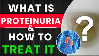What is Proteinuria -  Types , Causes & Treatment