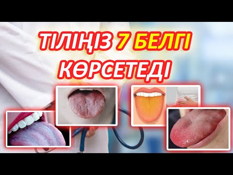 Бейне: Шығулар қай жерде жиі болады?