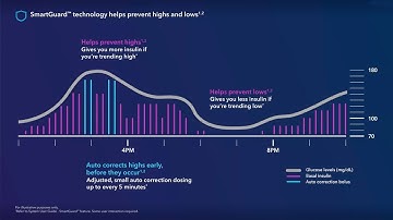 Tips for Using SmartGuard™ Technology with the MiniMed™ 780G System