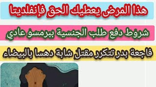 هذا المرض يعطي الحق فإنفلديتا+شروط تقديم الجنسية ببرمسو عادي+جريمة بدر تتكرر مقتل شابة دهسا❗