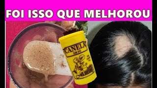 Receita Caseira Para Queda de Cabelo – Faz Crescer, Engrossar e Fortalecer o Cabelo