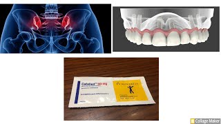 علاج آلام وإلتهابات ما بعد العمليات مثل عمليات الأسنان أو العظام (كتافاست – Catafast