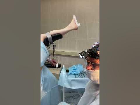 удаление геморроидальных узлов лазером - YouTube