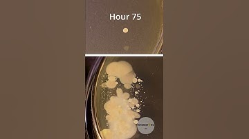 Washed vs dirty hands bacteria time lapse 🦠🧫 #bacteria #timelapse #shorts