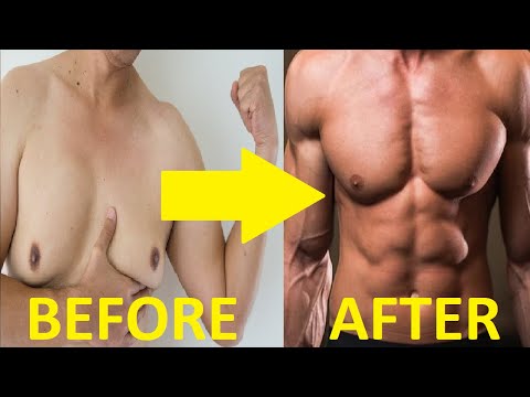 how-to-get-rid-of-gynecomastia-male