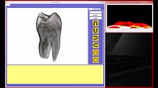 Volume Rendering with Qt Vol.12
