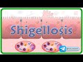 Shigellosis Microbiology  Animation : Pathogenesis, Clinical manifestations, Diagnosis & Treatment