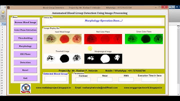 Blood Group Determination using Image Processing Matlab Project Code