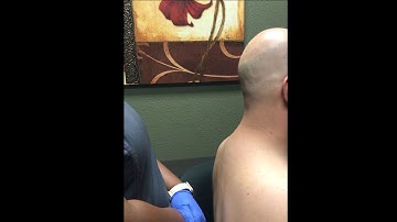 Trigger Point Injection Demonstration