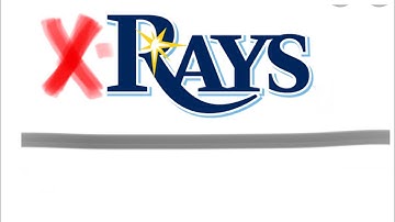 X rays part 1: including complete basic information of x rays  by Dr. Divya Jyoti Chawla